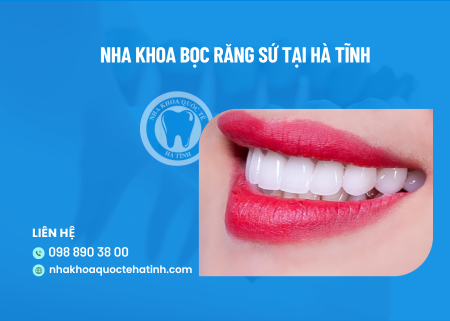 Nha khoa bọc răng sứ tại Hà Tĩnh – Top địa chỉ uy tín nhất (2024)