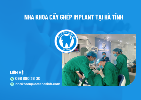 Nha khoa cấy ghép implant tại Hà Tĩnh