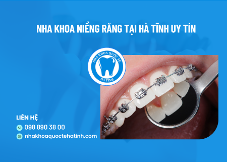 Nha khoa niềng răng tại Hà Tĩnh