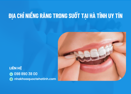 Địa chỉ niềng răng trong suốt tại Hà Tĩnh uy tín