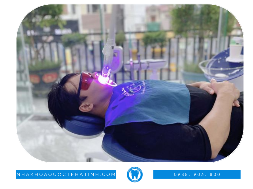 Tẩy trắng bằng Laser Whitening.