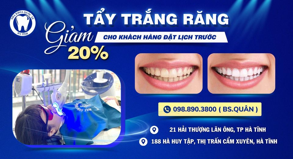 Dịch vụ tẩy trắng răng Laser Whitening uy tín tại Nha Khoa Quốc tế