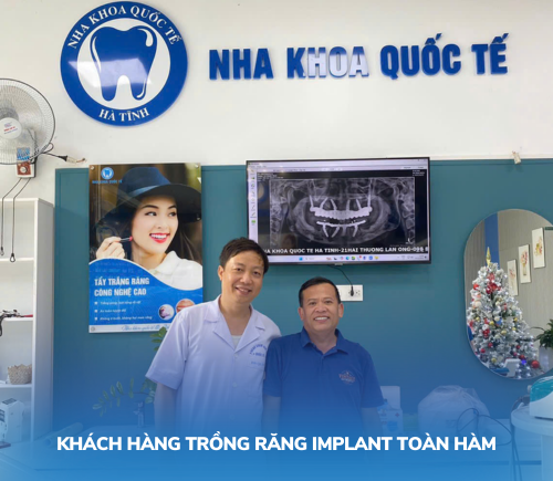 Trồng răng implant toàn hàm là gì?