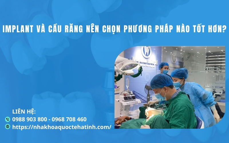 Implant và cầu răng nên chọn phương pháp nào tốt hơn?