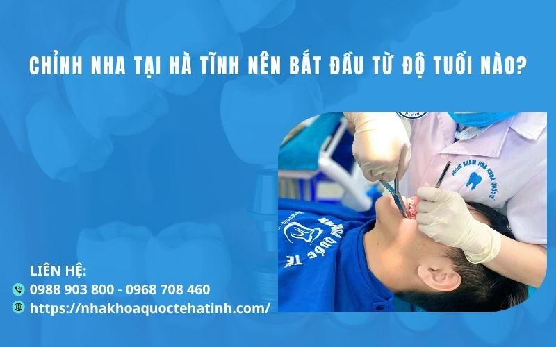 Chỉnh nha tại Hà Tĩnh nên bắt đầu từ độ tuổi nào?