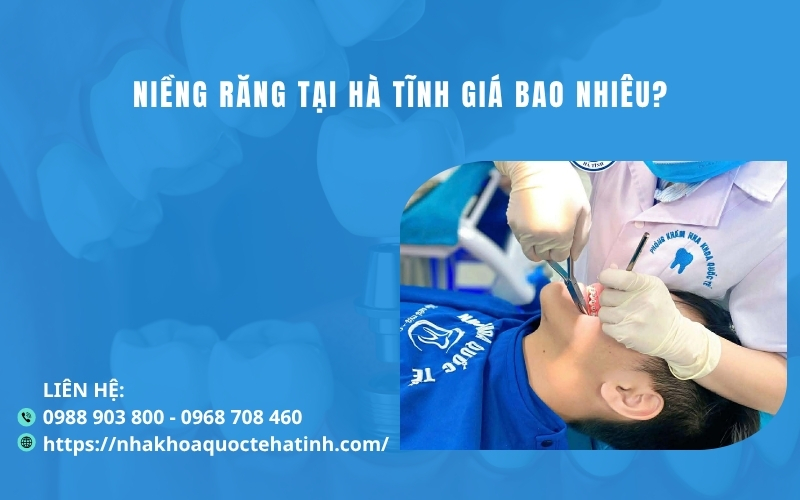 Niềng răng tại Hà Tĩnh giá bao nhiêu?