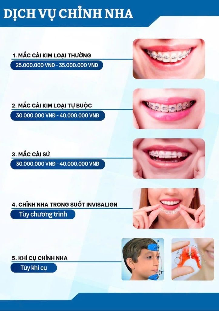Niềng răng tại Nha khoa Quốc tế với chi phí cạnh tranh nhất Hà Tĩnh