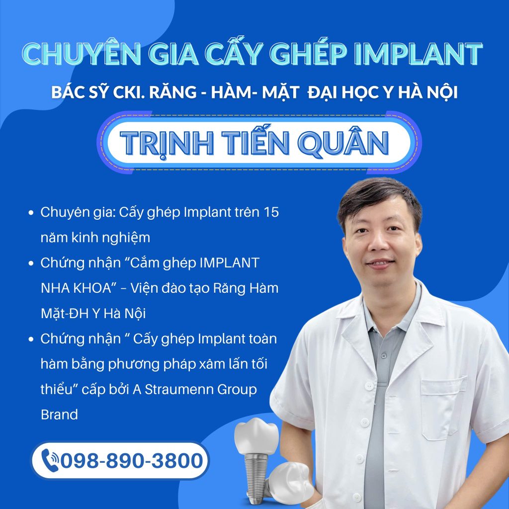 trong rang implant tai ha tinh