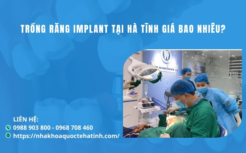 Trồng răng implant tại Hà Tĩnh giá bao nhiêu?