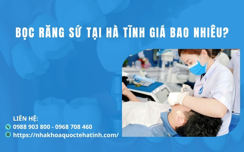 Bọc răng sứ Hà Tĩnh giá bao nhiêu?