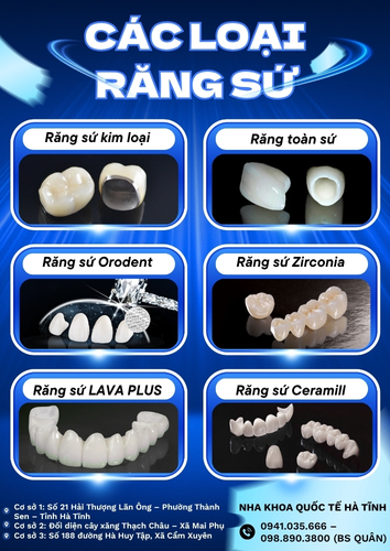 Các loại răng sứ tại Hà Tĩnh đa dạng về chất liệu, thẩm mỹ và độ bền