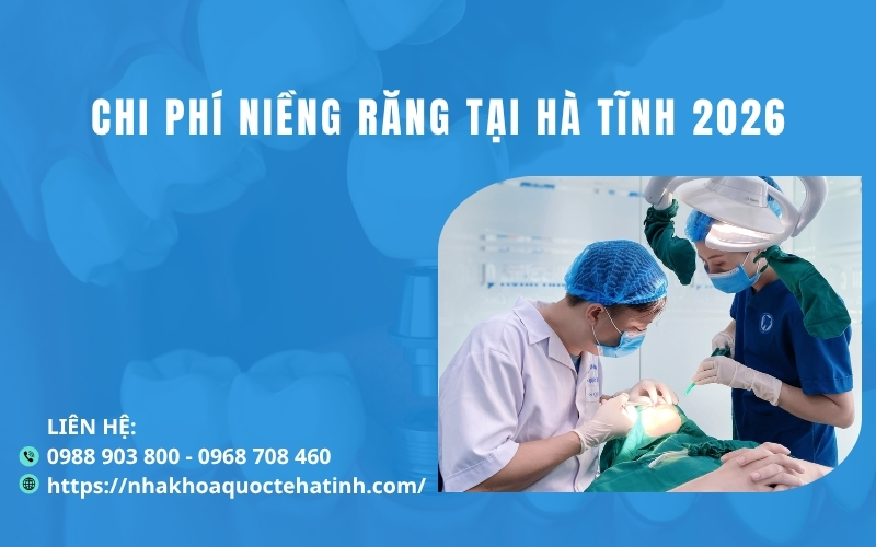 Chi phí niềng răng tại Hà Tĩnh 2026