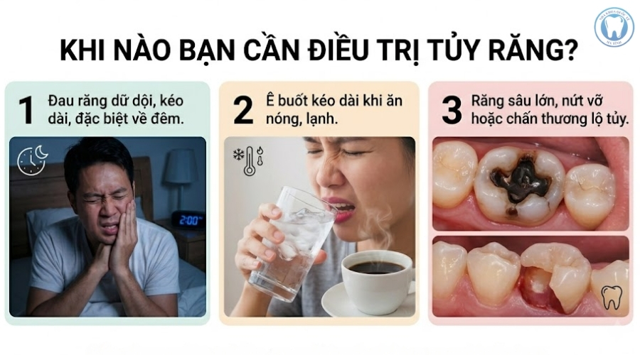 Nhận biết sớm dấu hiệu viêm tủy giúp điều trị hiệu quả và bảo vệ răng thật lâu dài