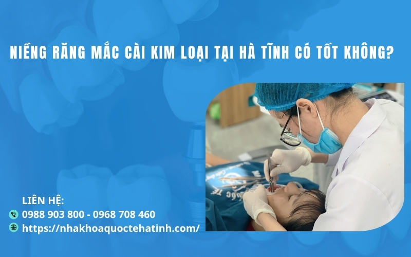 Niềng răng mắc cài kim loại tại Hà Tĩnh có tốt không?