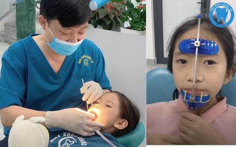 Niềng răng sớm giúp trẻ cải thiện khớp cắn, thẩm mỹ và phát triển răng hàm toàn diện