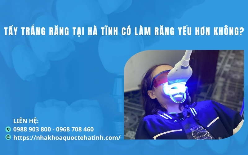 Tẩy trắng răng tại Hà Tĩnh có làm răng yếu hơn không?