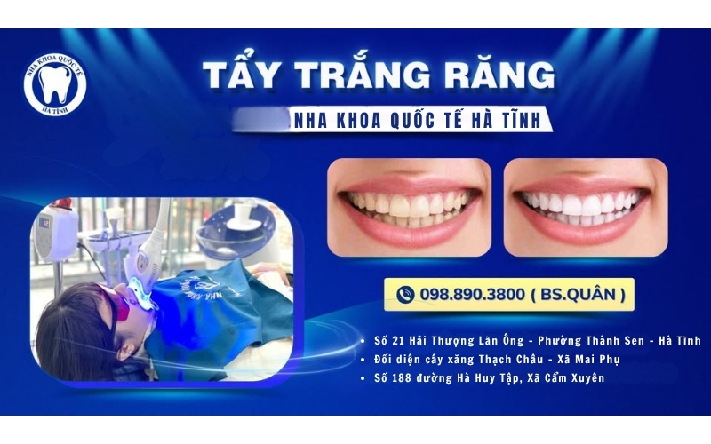 Nha Khoa Quốc Tế Hà Tĩnh mang đến dịch vụ chăm sóc răng an toàn, hiện đại, chuyên nghiệp