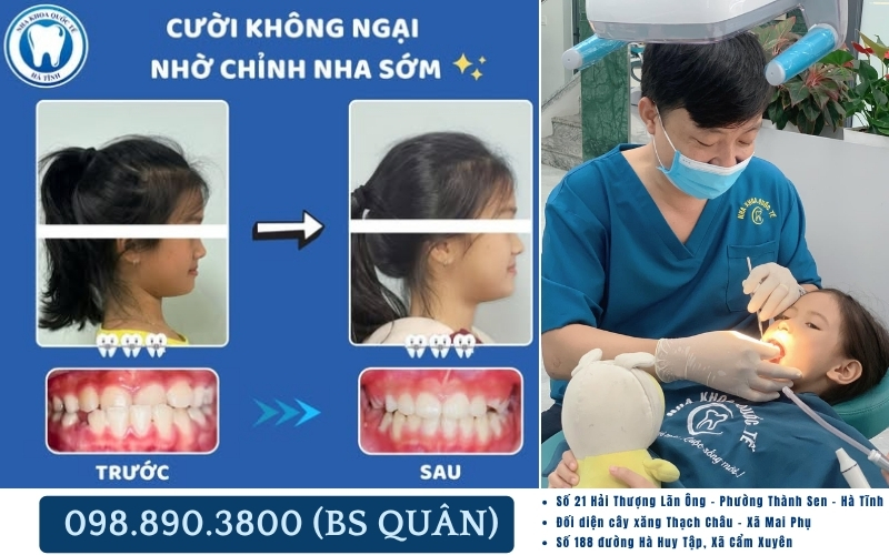 Đội ngũ bác sĩ giàu kinh nghiệm, công nghệ hiện đại cùng giá niềng răng tại Hà Tĩnh minh bạch
