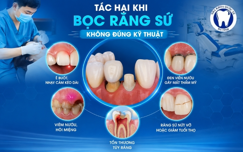 Bọc răng sứ sai kỹ thuật có thể gây ê buốt, viêm nướu và tổn thương răng
