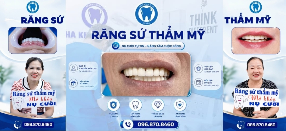 Bọc răng sứ là phương pháp phục hình hiện đại giúp cải thiện thẩm mỹ và bảo vệ răng thật