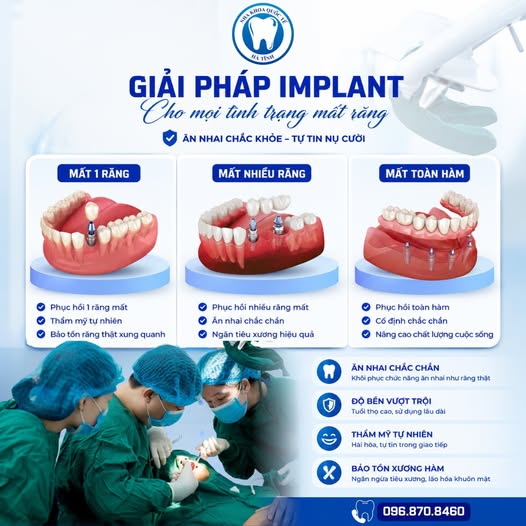 Trồng răng giả Implant phục hồi răng mất, ăn nhai chắc chắn và thẩm mỹ tự nhiên lâu dài