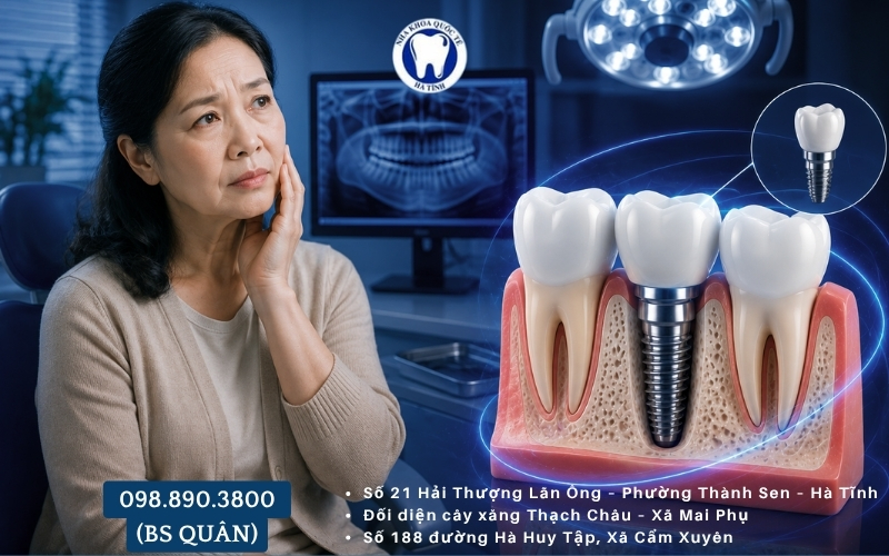 Cấy ghép Implant được thực hiện nhẹ nhàng, ít đau nhờ công nghệ hiện đại