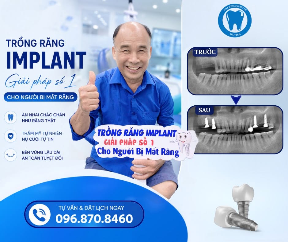 Trồng răng Implant mang lại hiệu quả lâu dài, tương xứng với chi phí đầu tư ban đầu