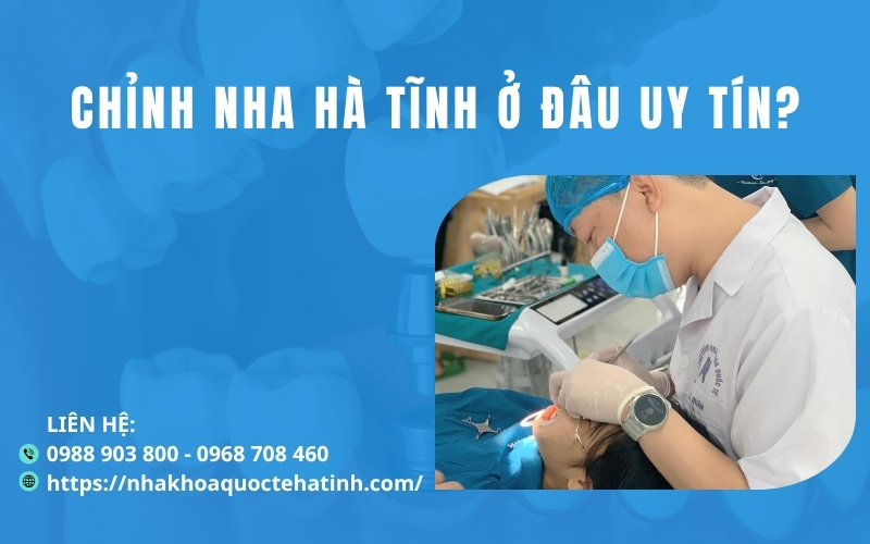 Chỉnh nha Hà Tĩnh ở đâu uy tín?