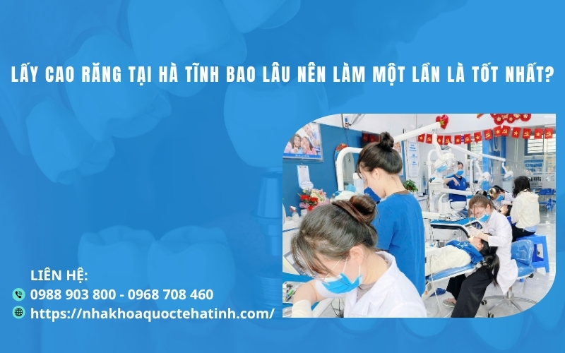 Lấy cao răng tại Hà Tĩnh bao lâu nên làm một lần là tốt nhất?