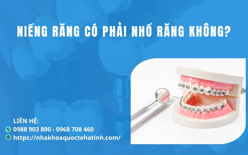 Niềng răng có phải nhổ răng không?