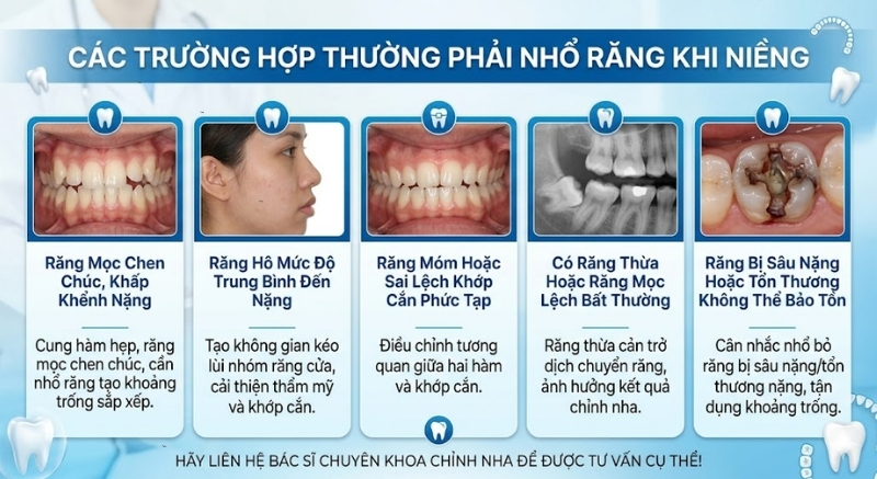Nhổ răng khi niềng thường áp dụng cho các trường hợp thiếu khoảng trống