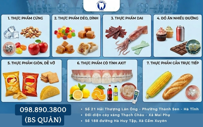 Niềng răng ko nên ăn gì gồm thực phẩm cứng, dẻo, dai, đường và đồ chua gây hại mắc cài