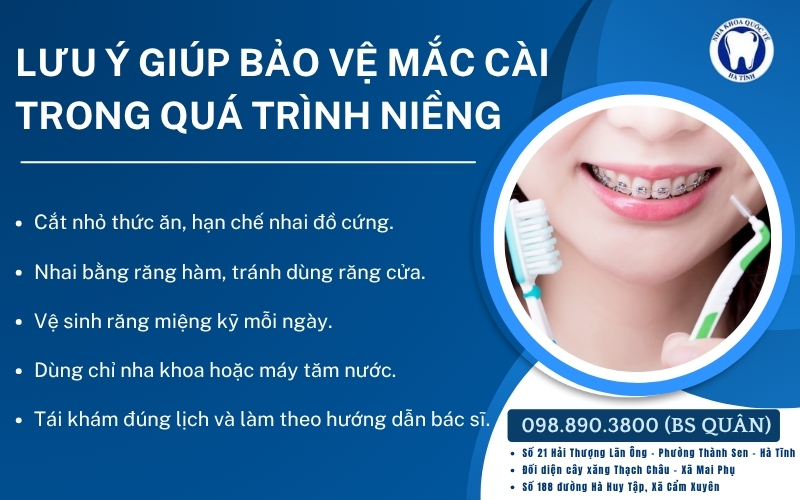 Lưu ý chăm sóc mắc cài giúp niềng răng an toàn, hiệu quả và ổn định hơn