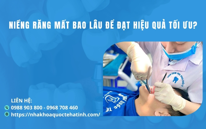Niềng răng mất bao lâu để đạt hiệu quả tối ưu?