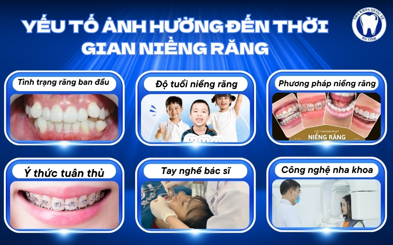 Thời gian niềng răng phụ thuộc tình trạng răng, phương pháp điều trị và sự tuân thủ phác đồ