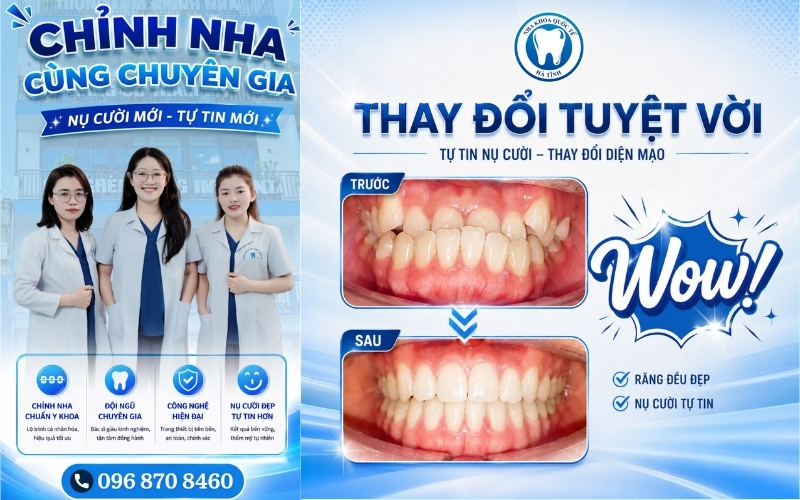 Nha Khoa Quốc Tế Hà Tĩnh mang đến giải pháp răng miệng an toàn, thẩm mỹ lâu dài