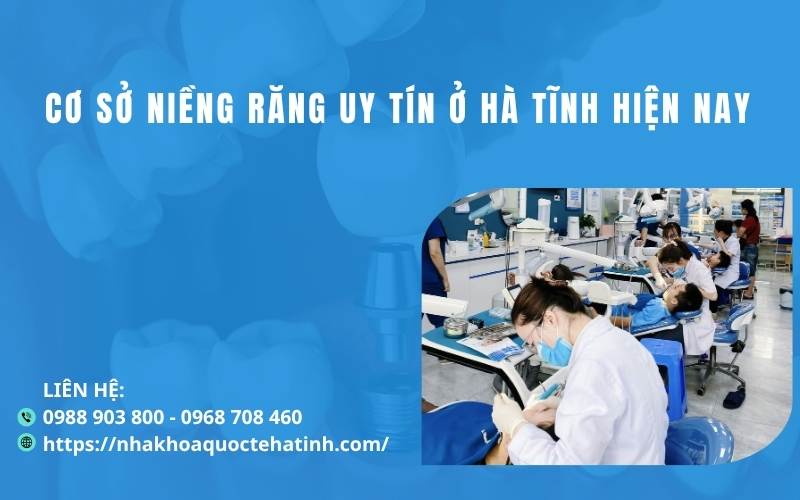 Cơ sở niềng răng uy tín ở Hà Tĩnh hiện nay 