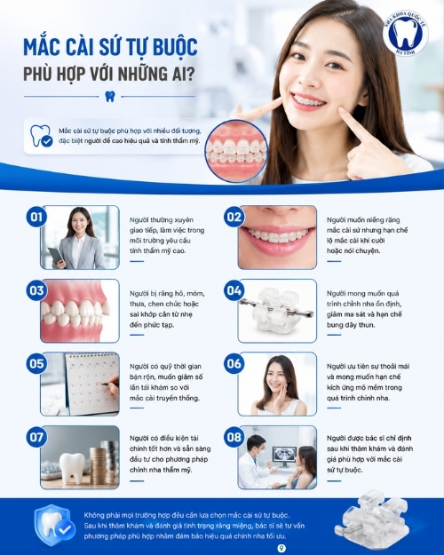 Mắc cài sứ tự buộc phù hợp với nhiều đối tượng, đặc biệt người đề cao hiệu quả và tính thẩm mỹ