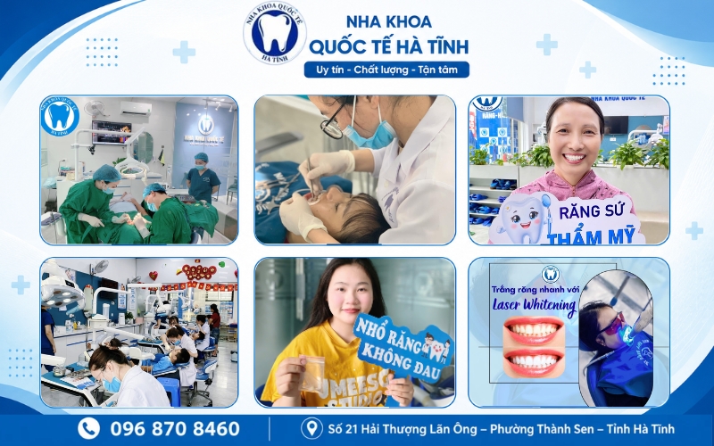 Nha khoa Quốc Tế Hà Tĩnh cung cấp đa dạng dịch vụ, đáp ứng toàn diện nhu cầu chăm sóc răng miệng
