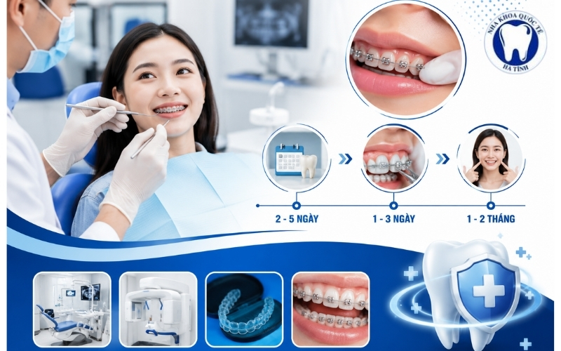 Cảm giác đau khi niềng răng chỉ kéo dài ngắn và giảm dần theo thời gian