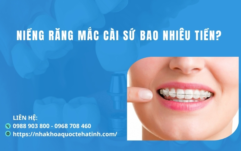 Niềng răng mắc cài sứ bao nhiêu tiền?
