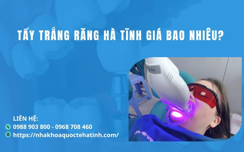 Tẩy trắng răng giá bao nhiêu?