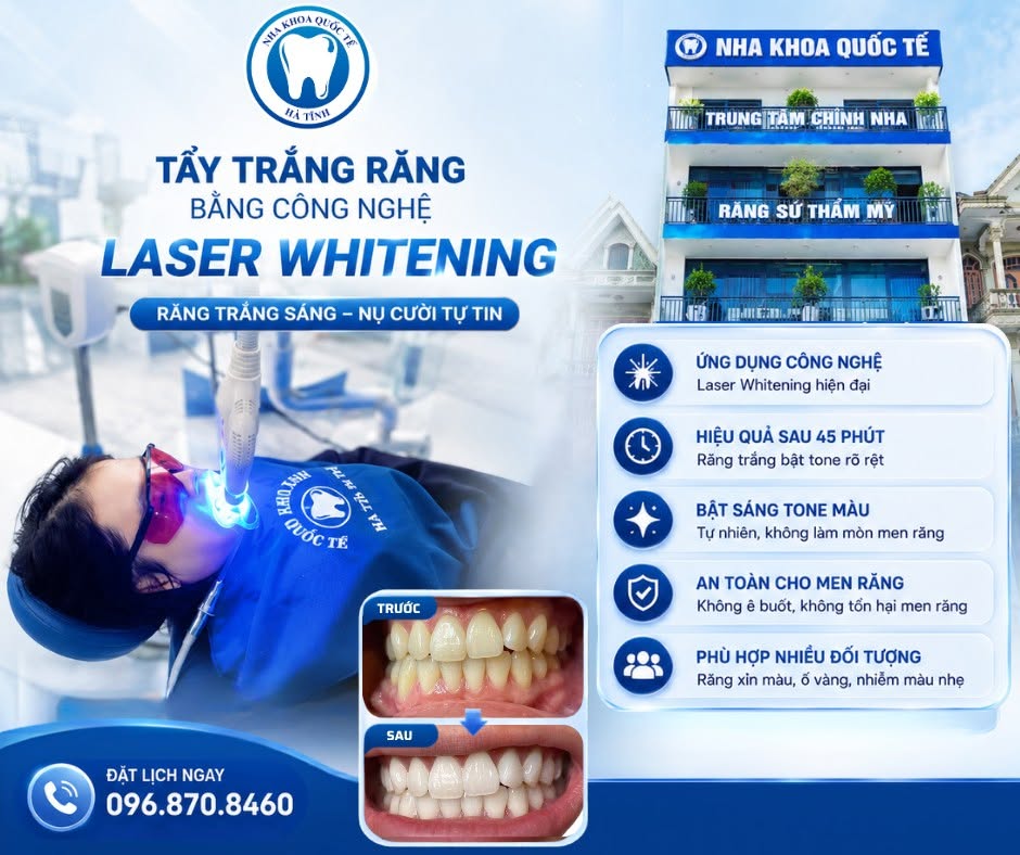 tẩy trắng răng hà tĩnh nha khoa quốc tế