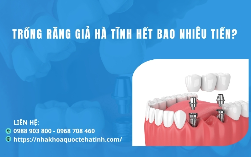 Trồng răng giả Hà Tĩnh hết bao nhiêu tiền?