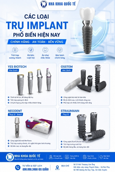 Các dòng trụ implant nổi tiếng trên thị trường