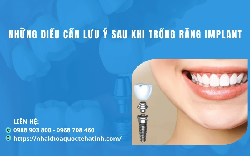 Những điều cần lưu ý sau khi trồng răng implant