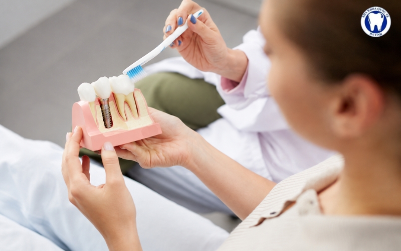Chăm sóc răng miệng đúng cách sau trồng răng Implant giúp ngăn ngừa viêm nhiễm, duy trì hiệu quả lâu dài