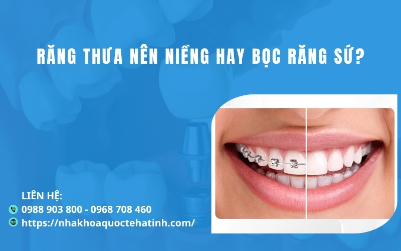 Răng thưa nên niềng hay bọc răng sứ?