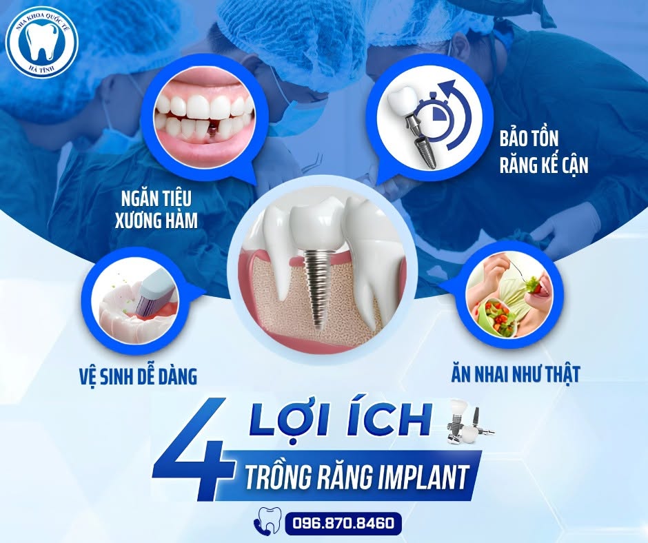 Trồng răng Implant giúp người mất răng lâu năm phục hồi ăn nhai, thẩm mỹ và hạn chế tiêu xương hàm