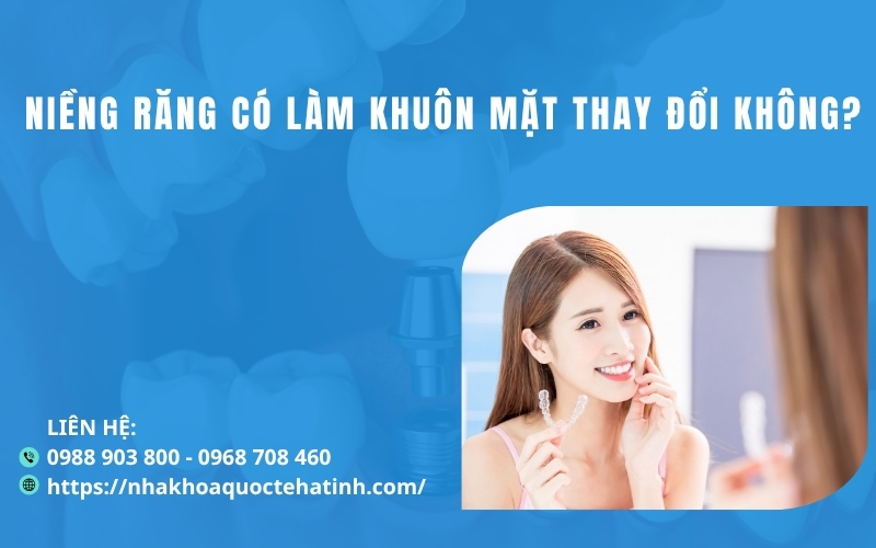 Niềng răng có làm khuôn mặt thay đổi không?